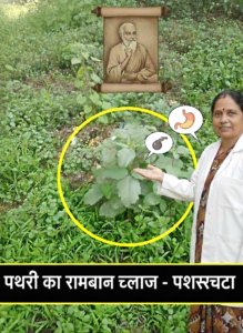 Acute stone treatment with stones.